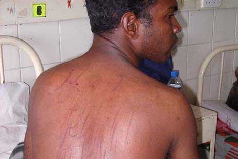 Report highlights cases of torture