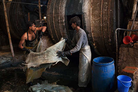 The extremely unhealthy life of the Bangladesh tannery worker 