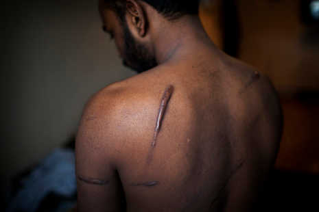 New evidence of torture by Sri Lanka's security forces