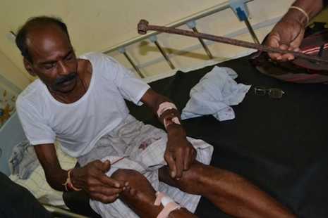 Sri Lankan Tamil activist hospitalized after attack by assailants