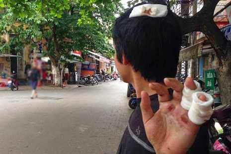 Blogger attacked by brick-wielding ‘security personnel’ in Vietnam