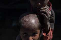 Rohingya: divided by age and a desire for retribution