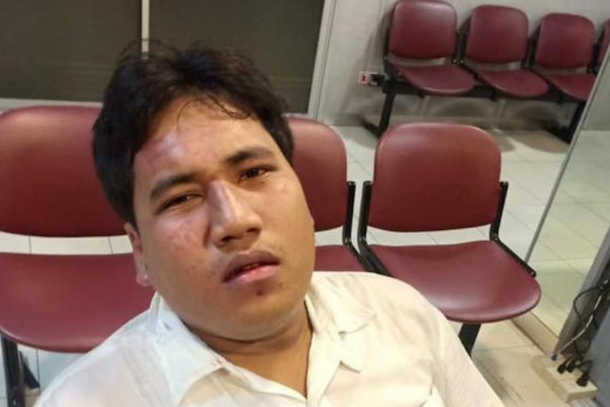 Thai democracy activist badly injured in street attack