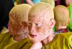Malawi priest sentenced to 30 years for murder of man with albinism
