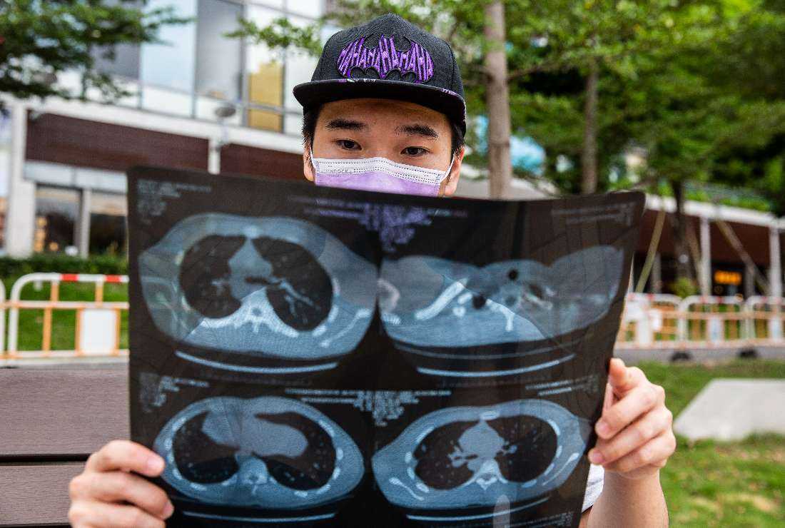 Tsang Chi-kin, who was shot in the chest by police in 2019, amid huge pro-democracy demonstrations on China's National Day, holding an X-ray of his wounds during an interview with Agence France-Presse in Hong Kong, on Oct. 7, 2020